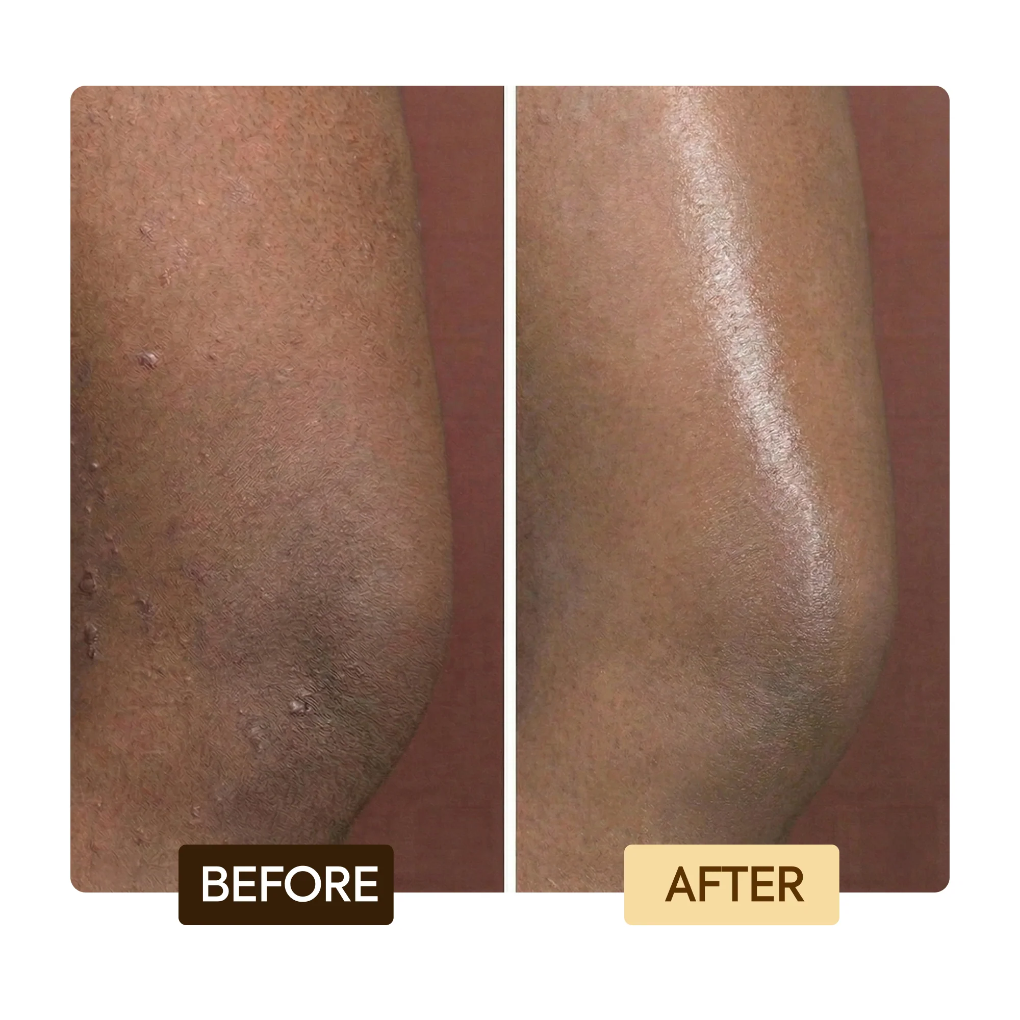 Exclusive Tone Boosting Body Glycerin - Image 5