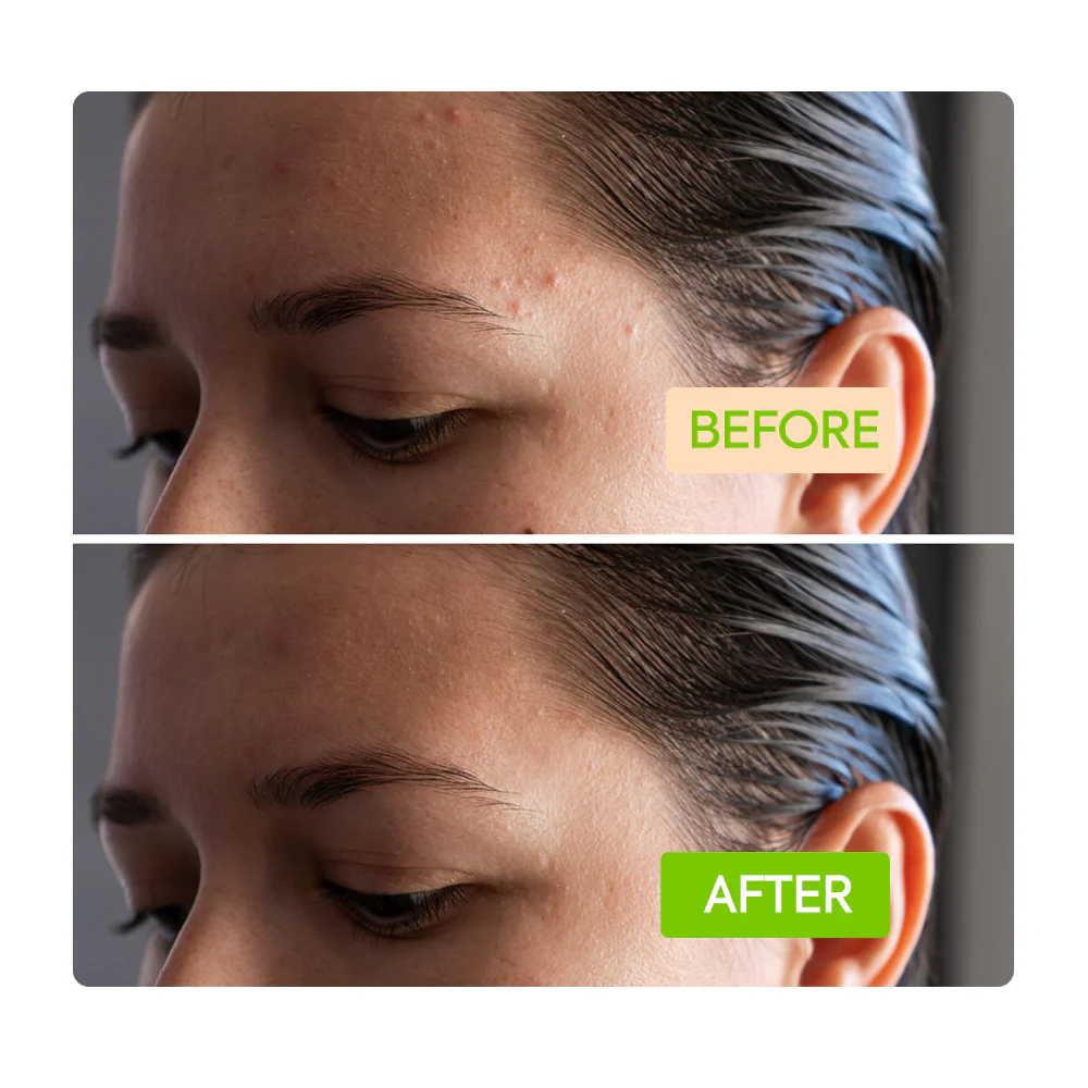 Ginger Cleansing Bar - IYKYK - Image 5