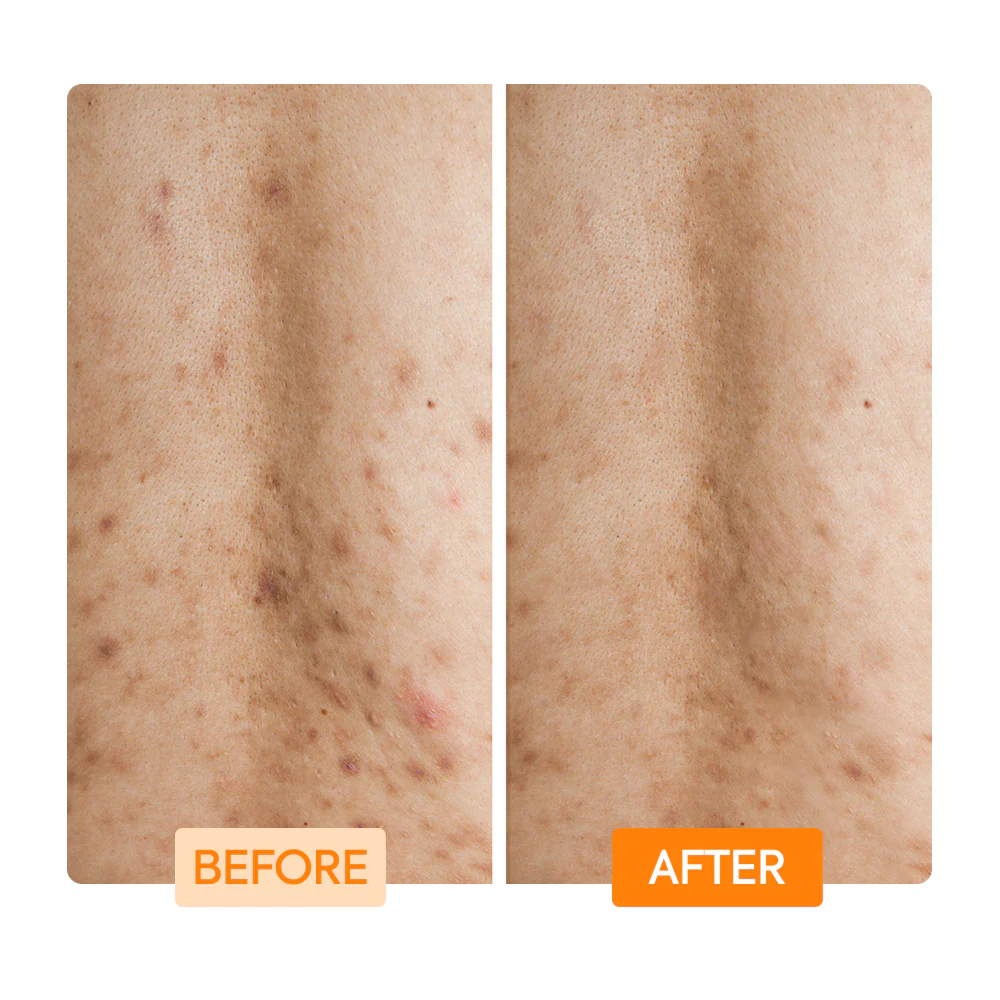 Glycolic + Lactic Acid + Niacinamide Body Wash - IYKYK - Image 5