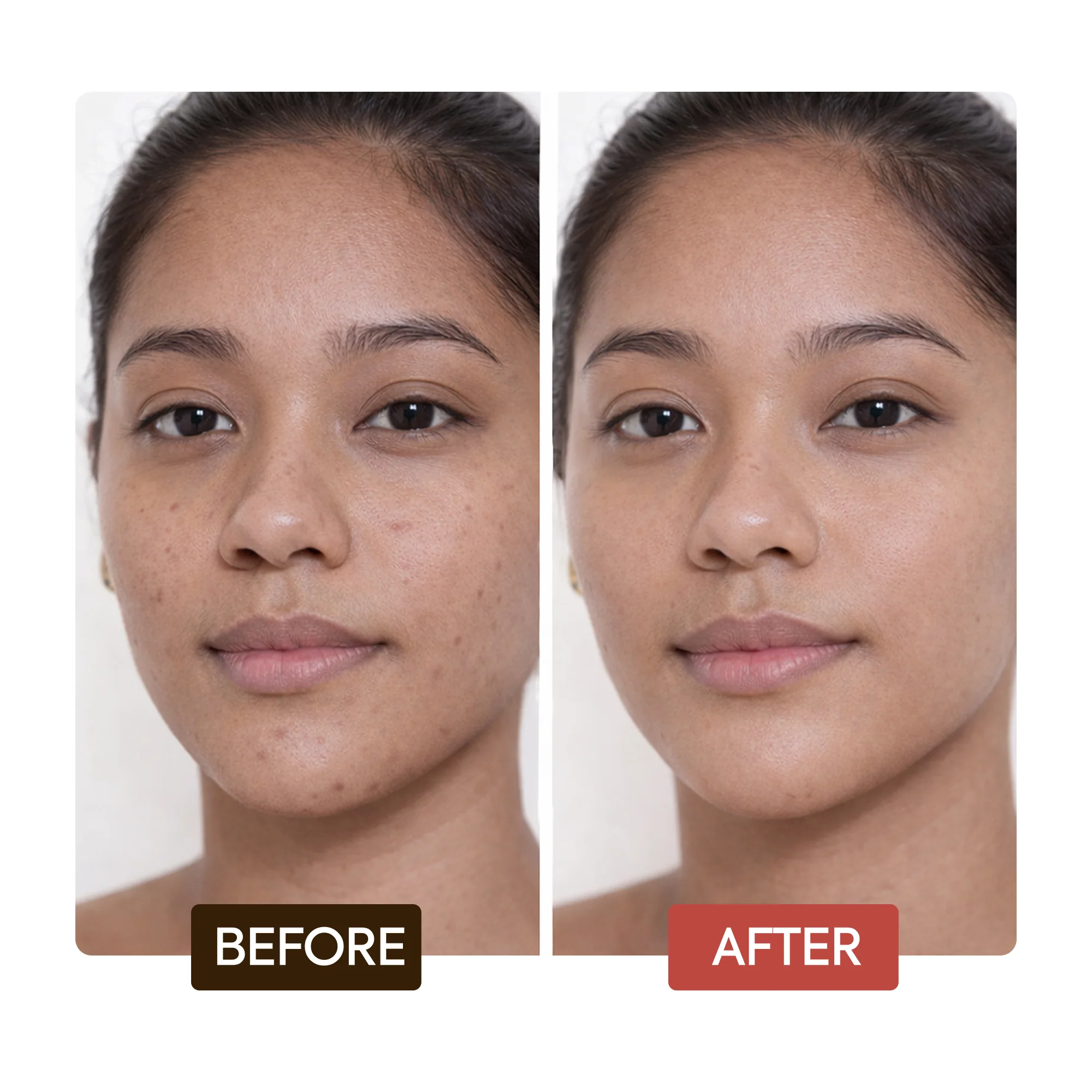 Naturalle Intense Extreme Glow Rejuvenating Complexion Soap - Image 5