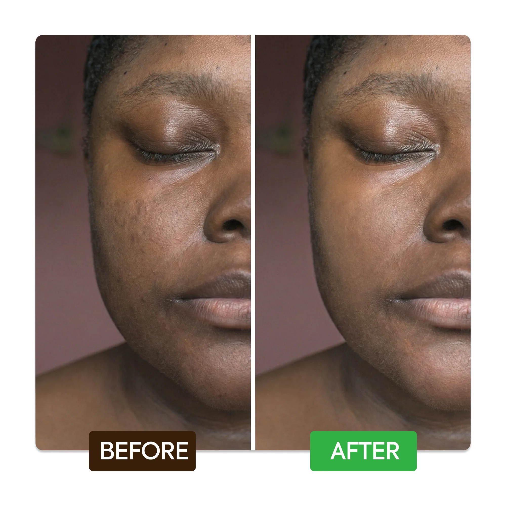 Kojic & Azelaic Brightening Serum - Image 6