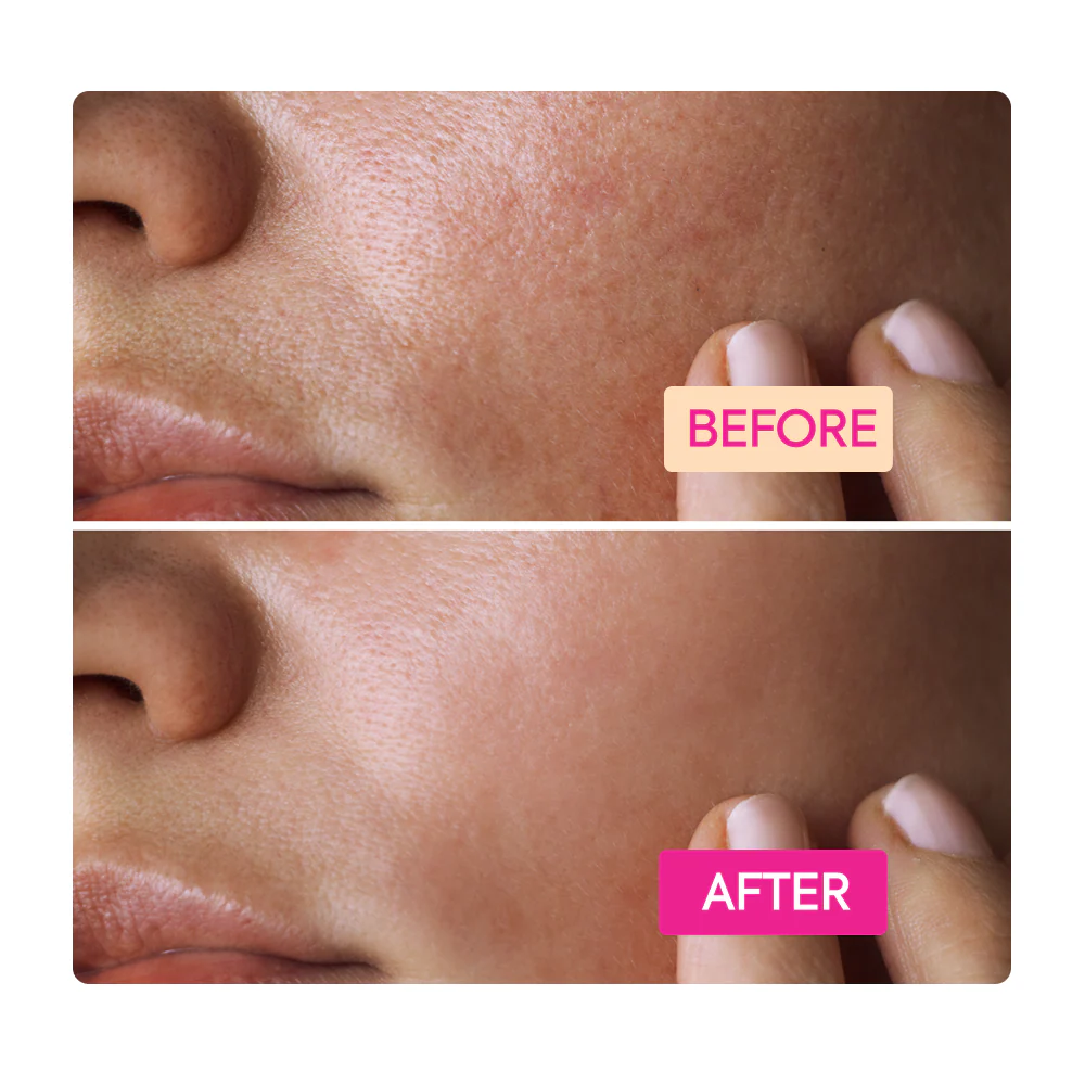 Niacinamide Facial Cleansing Bar - IYKYK - Image 4