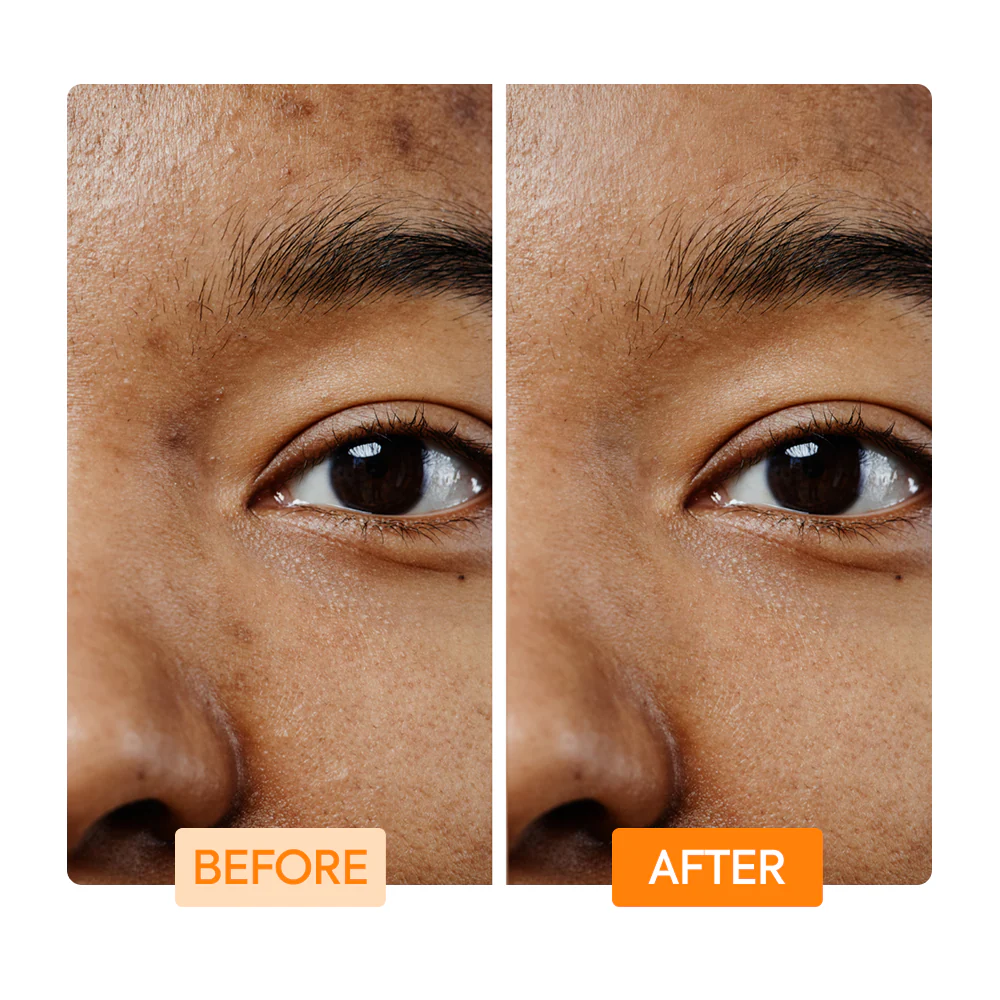 Vitamin C & Turmeric Facial Cleansing Bar - IYKYK - Image 5